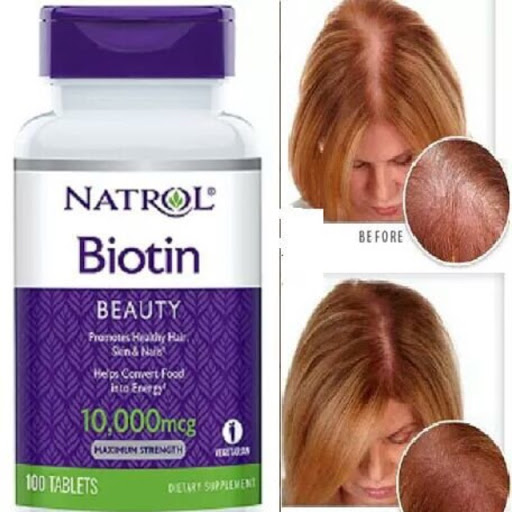 Viên Uống Giảm Rụng Tóc Biotin 10000mcg Natrol