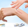 Kem trị sẹo Dermatix Ultra 7g - Hình ảnh 4