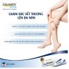 Kem trị sẹo Dermatix Ultra 7g - Hình ảnh 2