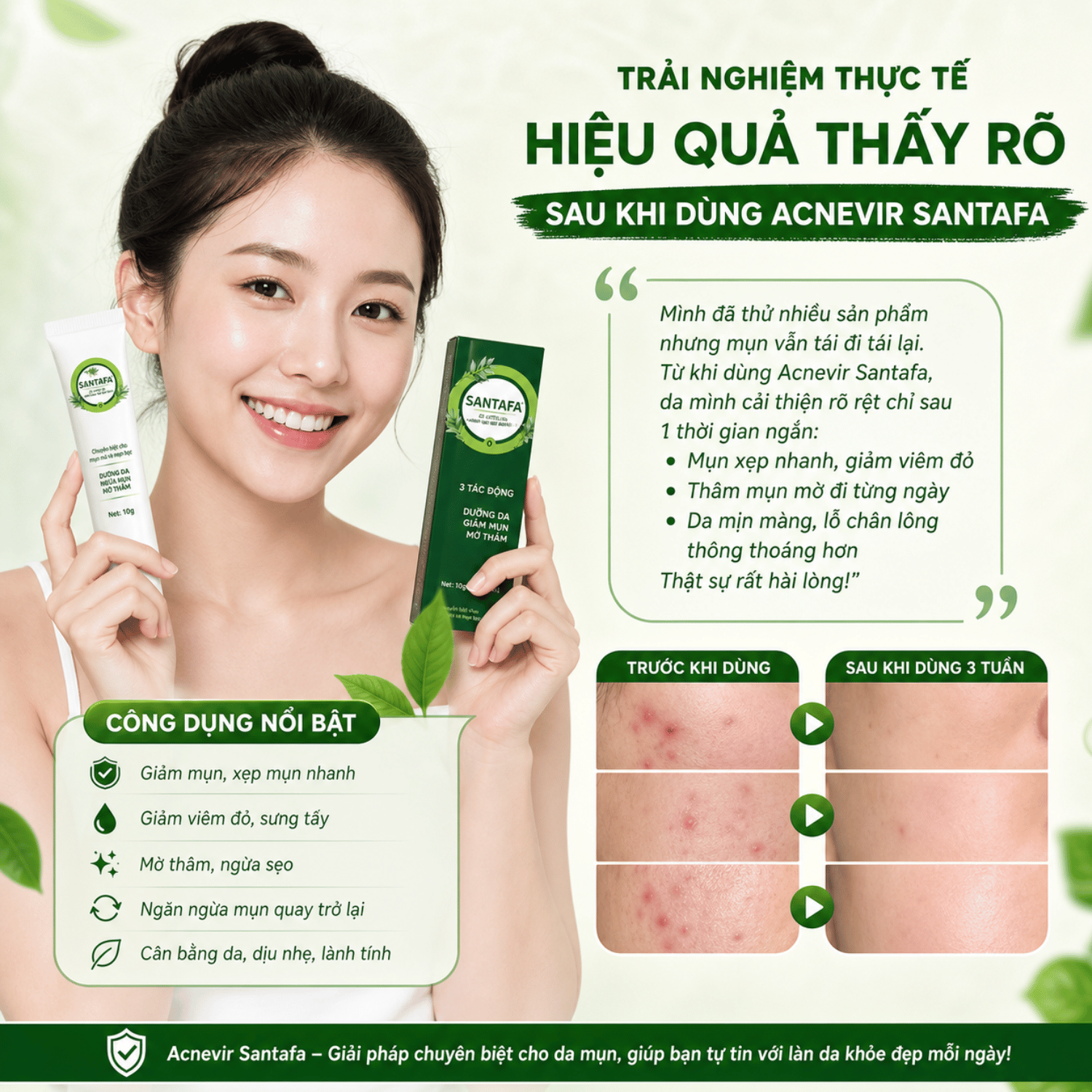 ACNEVIR SANTAFA – Kem Chấm Mụn Viêm, Mụn Bọc, Mụn Mủ Hiệu Quả Tuyp 10g - Ảnh 3